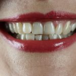 Zubné implantáty: Čo obnášajú a ako sa o ne starať?